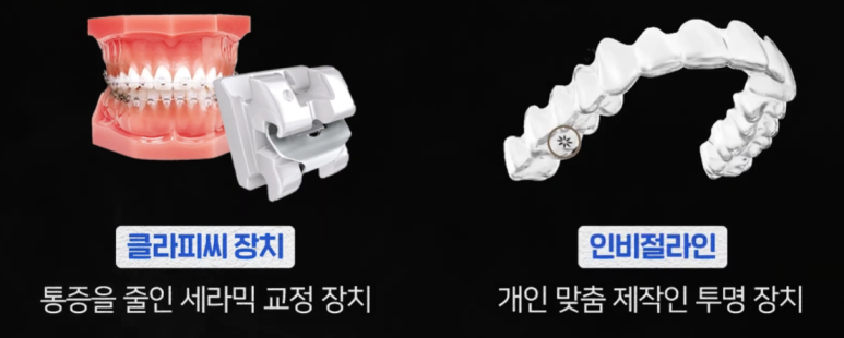 발치 없이 가능할까? 앞니 부분교정 전 반드시 체크해야 할 진단 포인트 관련 이미지 15