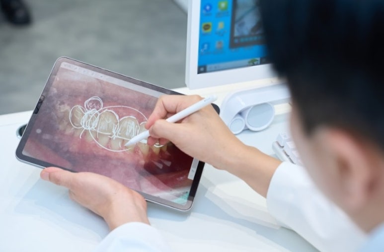 블랑쉬, 예술작품은 이렇게 완성됩니다. [시술 과정] 관련 이미지 4