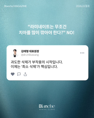 무삭제 라미네이트는 "부작용"이 없다? 관련 이미지 4