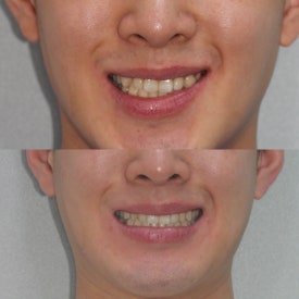 반포교정치과 고르는 3가지 기준,가격 투명 공개 관련 이미지 7