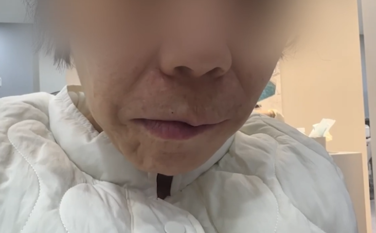 노인틀니 vs 디지털풀아치, 부모님 씹는 힘 2배 높이는 선택 기준 관련 이미지 10