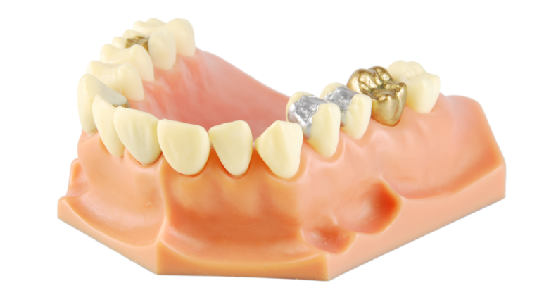 Symptoms of Acute Pulpitis: The Standard a Dentist Uses to Judge, “This Is Too Late” image 4