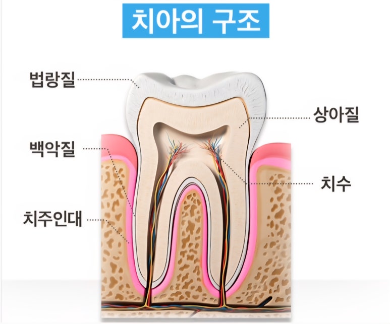 무삭제라미네이트 비용에 관한 숨겨진 진실, 모두 공개합니다. 관련 이미지 5