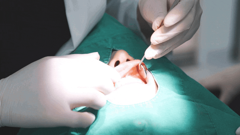 임플란트가 두렵다면 반드시 읽으세요! 관련 이미지 11