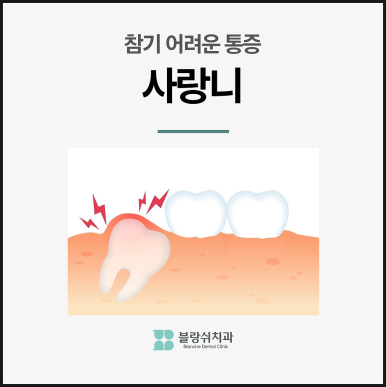 사랑니 발치 통증 붓기 언제까지?블랑쉬에서 알려드림 관련 이미지 7