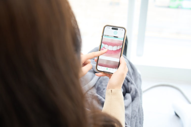 압구정 치과의사가 알려주는 돈줘도 안쓰는 치약 vs 추천하는 치약 관련 이미지 10