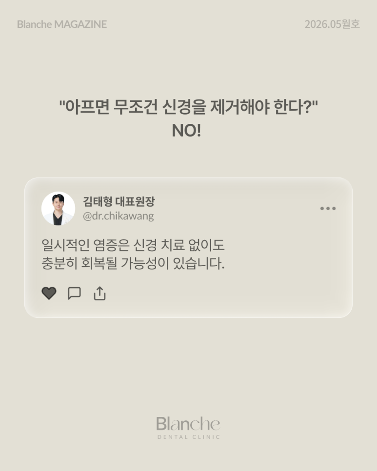 신경 치료, 아프면 무조건 해야 할까요? 자가 체크 가이드 관련 이미지 5