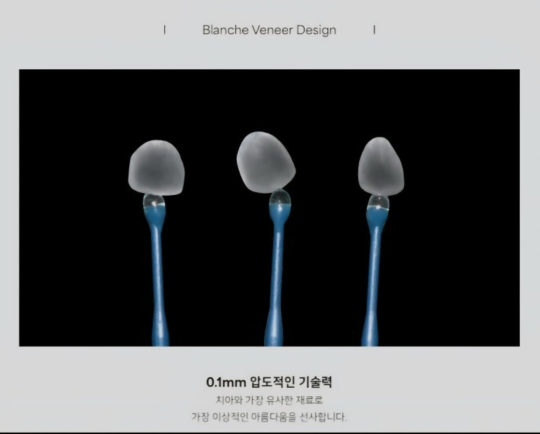 무삭제라미네이트 비용에 관한 숨겨진 진실, 모두 공개합니다. 관련 이미지 13