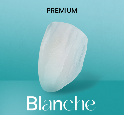 [블랑쉬치과] 치아 교정하고 난 후에 블랑쉬 가능할까요? 관련 이미지 8