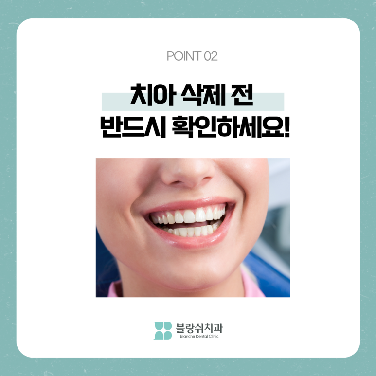 라미네이트 부작용 치아 삭제 전 반드시 알아야 할 것 관련 이미지 3