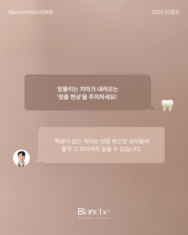 어금니 뺀 자리, 당장 안 아픈데 꼭 임플란트 해야 할까? 관련 이미지 8