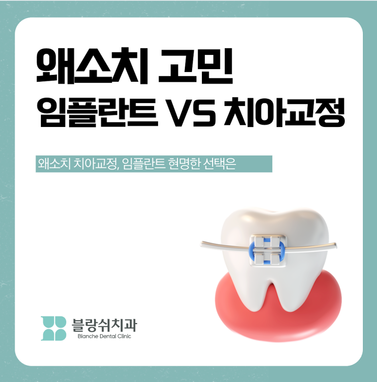 왜소치 치아교정 임플란트 고민이라면 관련 이미지 1