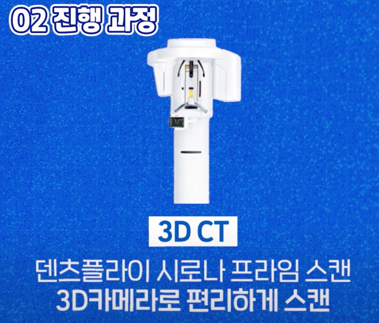 풀아치 임플란트 치과? 임플란트 결정 전 꼭 읽어보세요. 관련 이미지 6