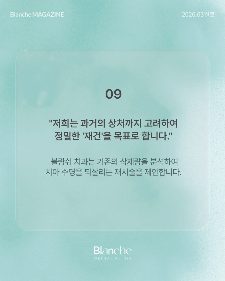 옛날에 한 라미네이트, 요즘 자꾸 신경 쓰인다면? 관련 이미지 14