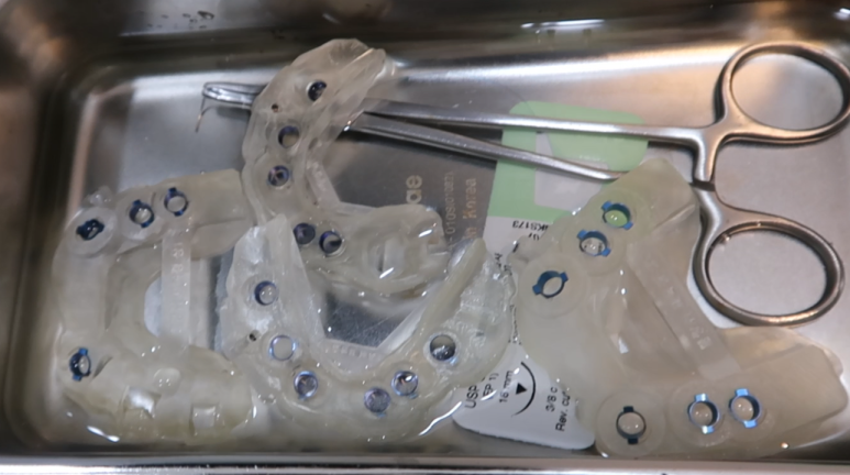 임플란트가 두렵다면 반드시 읽으세요! 관련 이미지 15