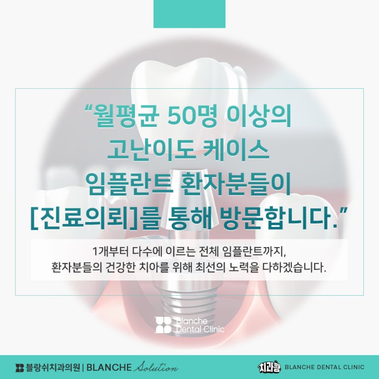 수면임플란트센터, 프리미엄 임플란트 진료는 블랑쉬치과(Blanche Dental Clinic) 관련 이미지 15