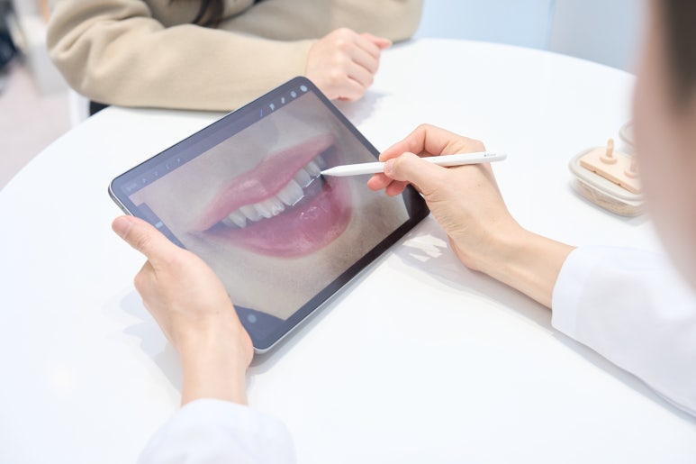 무삭제 라미네이트 추천, 어떤 케이스에 적합할까요? 관련 이미지 5