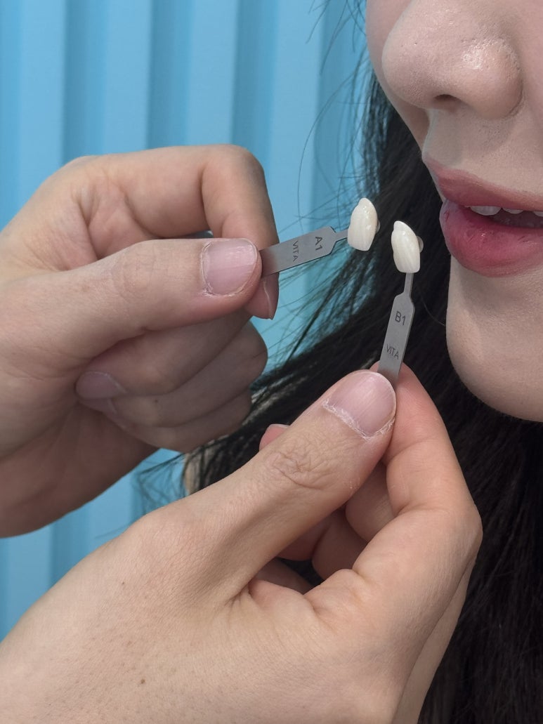 자가치아미백? 이것만으로는 어려운 이유 관련 이미지 5