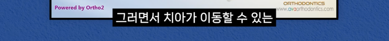 압구정치과 치아교정이 고민이라면 필독 관련 이미지 6