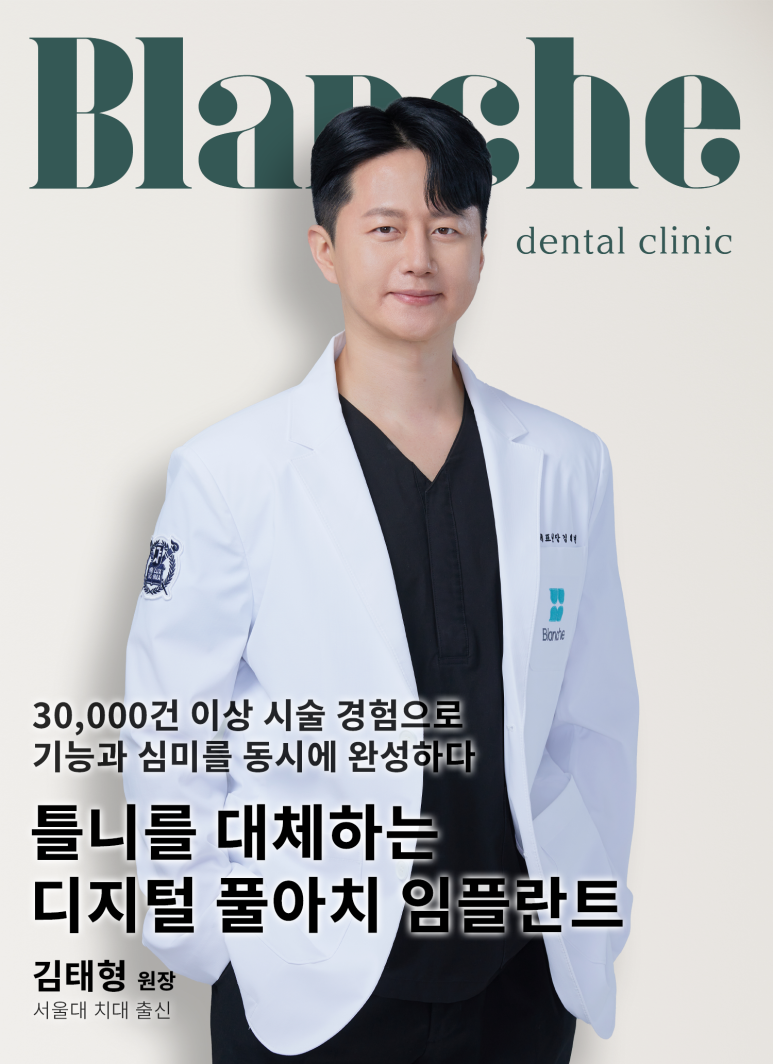 풀아치 임플란트 비용, 방법, 효과 모두 정리했습니다. 관련 이미지 1