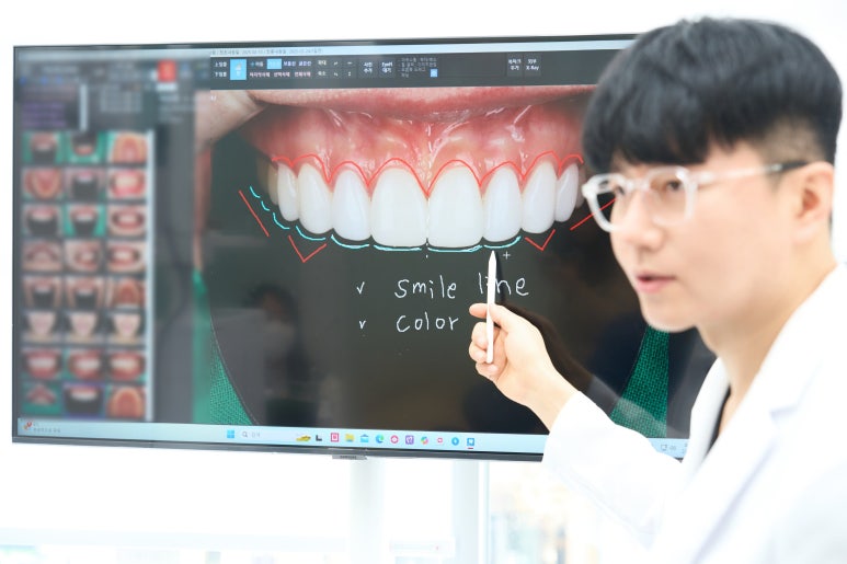 라미네이트 통증 이건 알아야 덜 불안합니다. 관련 이미지 5