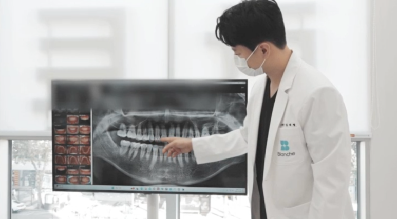 임플란트, 제대로 알고 가기 ② 임플란트 가격, 싼 곳이 비싸지는 3가지 함정 관련 이미지 6