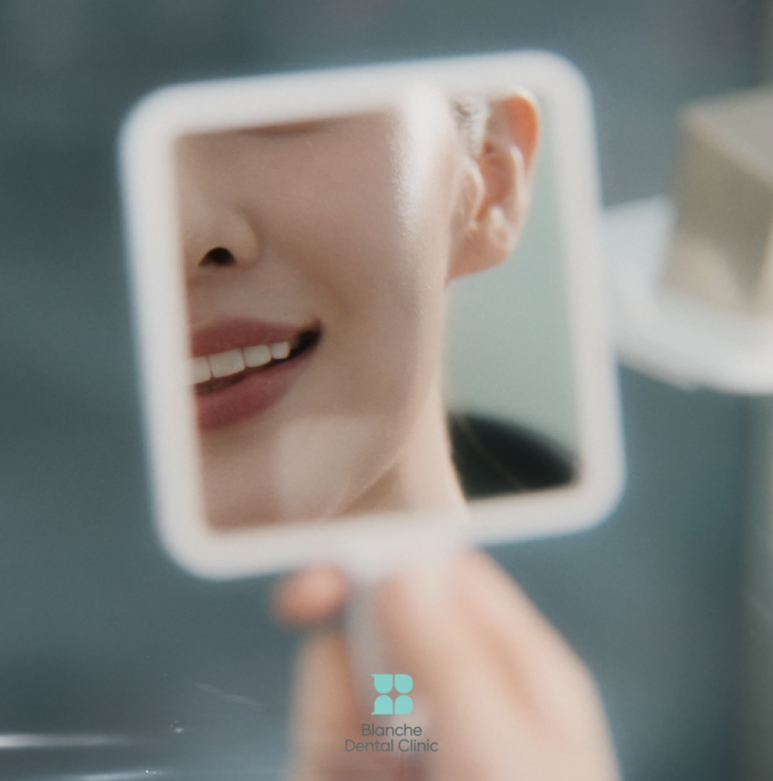 With Dental Implants, Lasting Longer Matters More Than Placing Them Well — Banpo Blanche Dental Clinic image 2