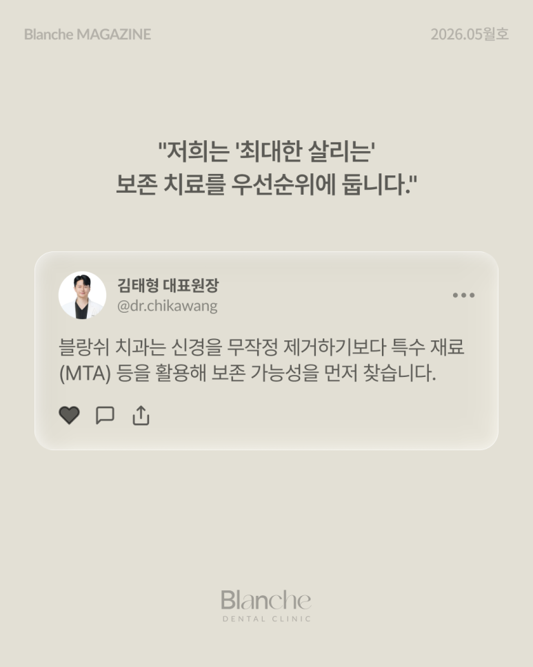신경 치료, 아프면 무조건 해야 할까요? 자가 체크 가이드 관련 이미지 15