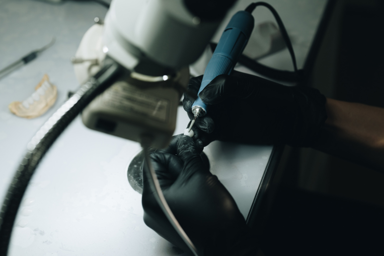 무삭제 라미네이트 부작용, 모르고 진행하면 손해보는 이유 관련 이미지 6