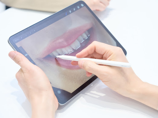 무삭제라미네이트 비용에 관한 숨겨진 진실, 모두 공개합니다. 관련 이미지 11