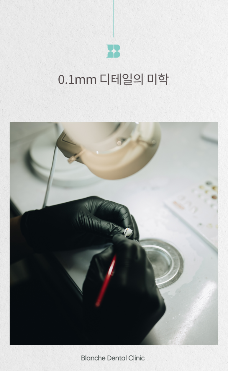 If You’ve Been 고민ning About the Price of Blanche Laminate, This Article Is Enough. image 4