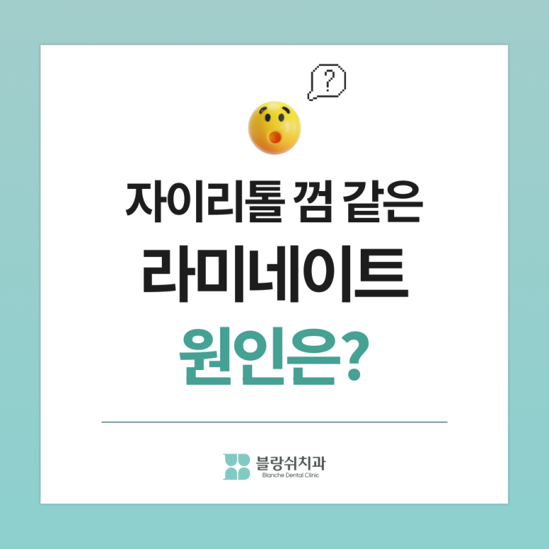 연예인 라미네이트 티 안나고 자연스러운 이유 관련 이미지 6