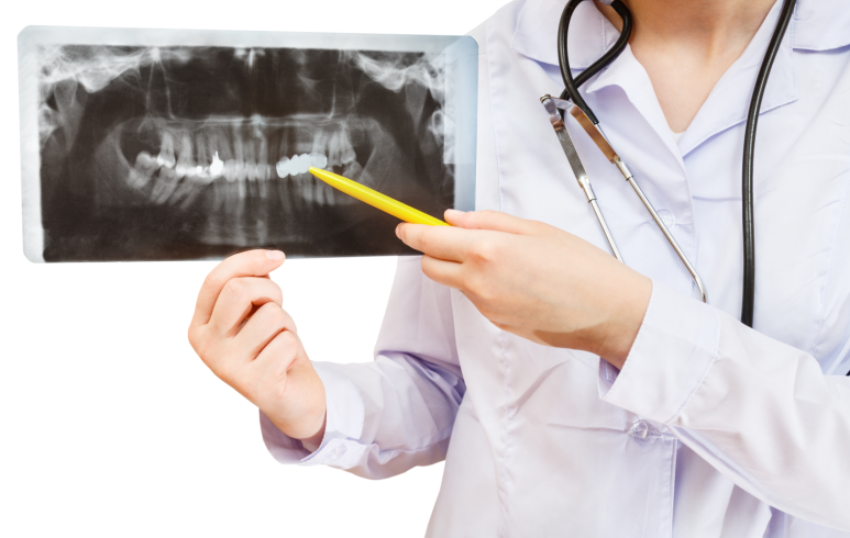 충치 신경치료 비용 건강보험 되는 경우 안 되는 경우 관련 이미지 3