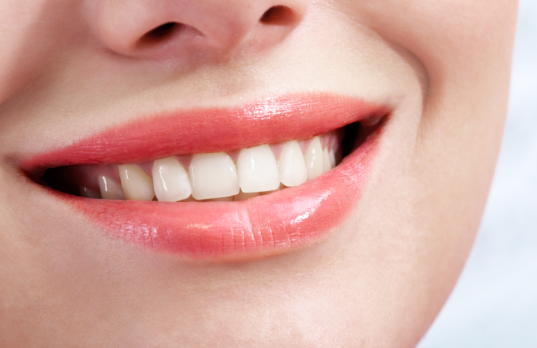 Do You Really Need to Have Teeth Extracted for Orthodontic Treatment? Why Blanche Dental Clinic Takes a Careful Approach to Extractions image 4