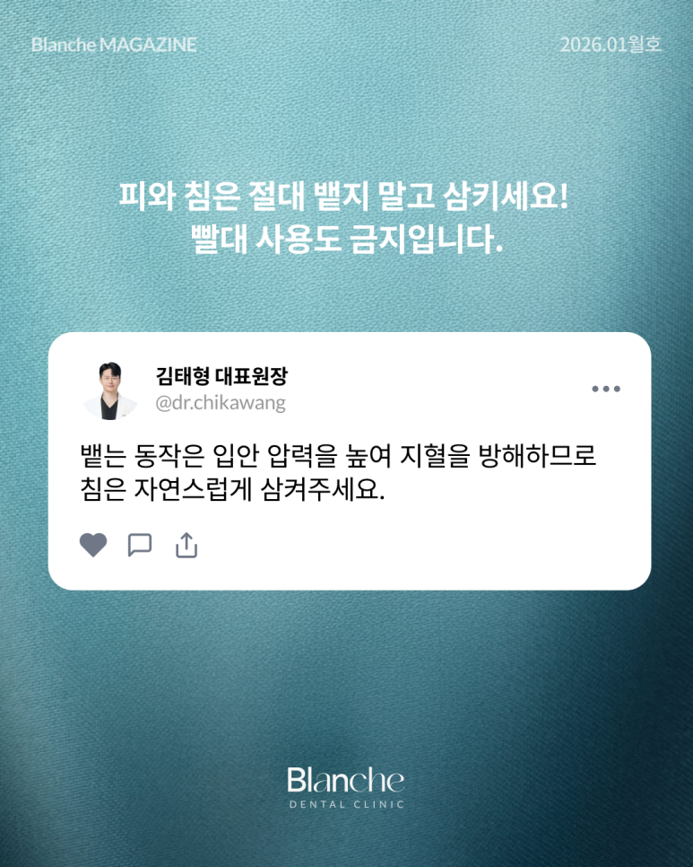 임플란트 사후관리는 어떻게?? 관련 이미지 4