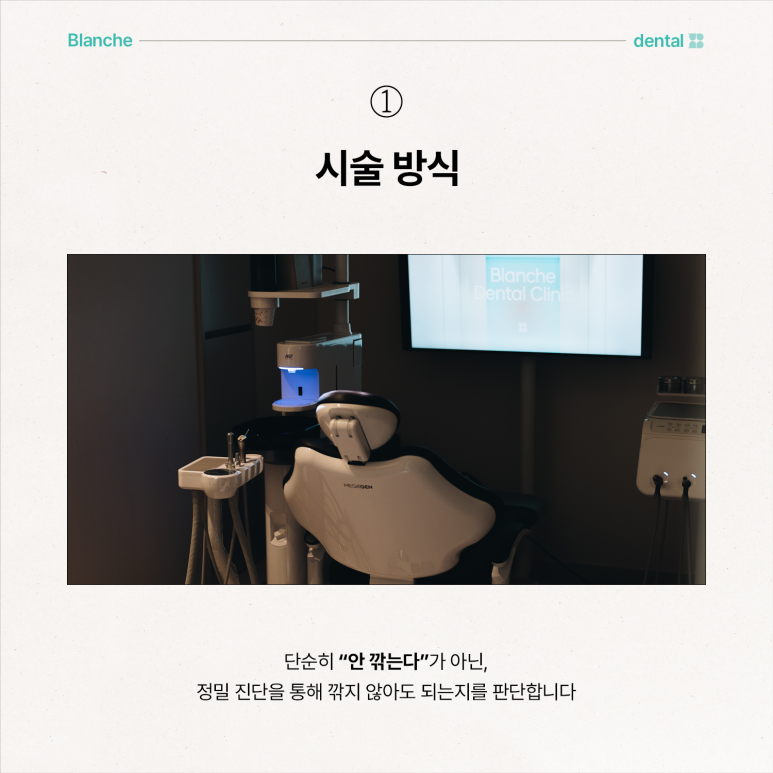 무삭제 라미네이트 부작용, 모르고 진행하면 손해보는 이유 관련 이미지 8