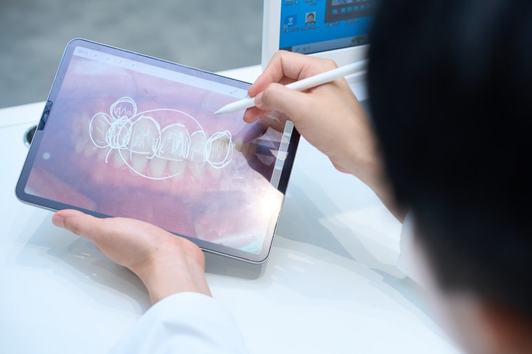 무삭제라미네이트단점, 관련 이미지 2