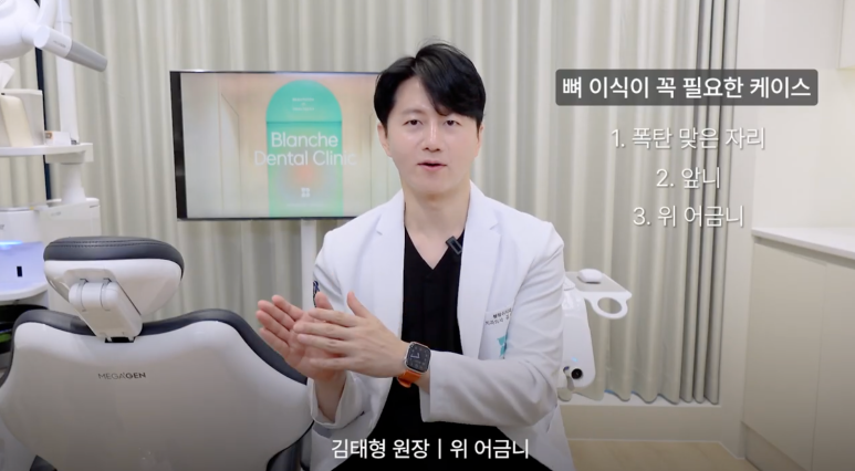 어금니 임플란트 뼈이식 통증 비용 총정리 관련 이미지 12