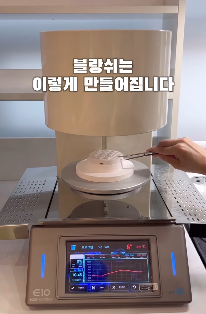 치아 무삭제 라미네이트, 관련 이미지 12