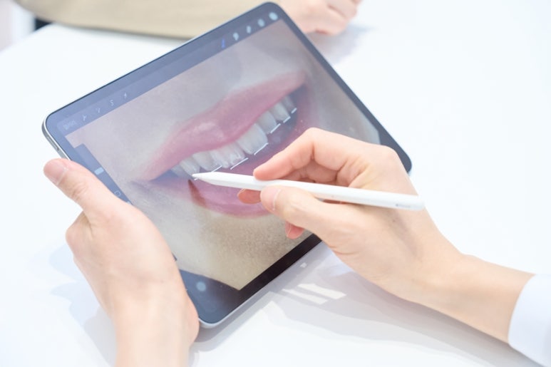 라미네이트 후기, 하얗다고 다 예쁜 건 아닙니다 관련 이미지 1