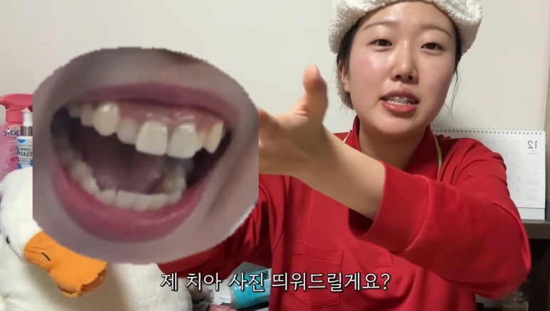 Tsukkar Orthodontics? The Story of Influencer Tsukkar’s Ongoing Orthodontic Treatment at Blanche image 3