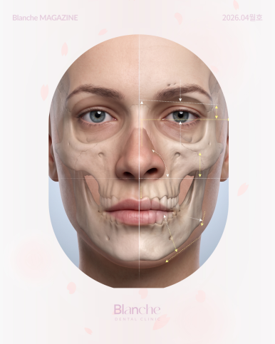 Facial Asymmetry? If Your Jaw Makes a Sound, Check This at Home First! image 3