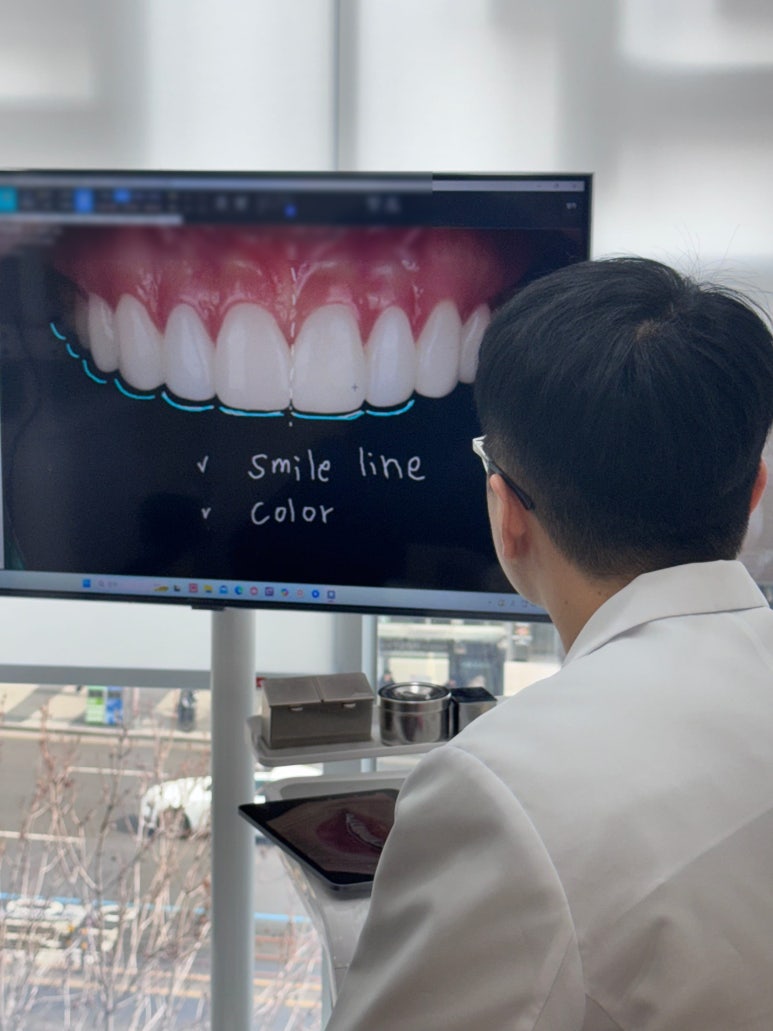 자가치아미백? 이것만으로는 어려운 이유 관련 이미지 10