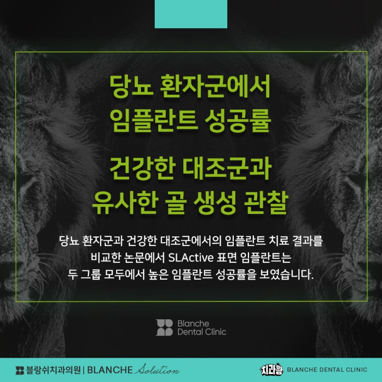 수면임플란트센터, 프리미엄 임플란트 진료는 블랑쉬치과(Blanche Dental Clinic) 관련 이미지 21