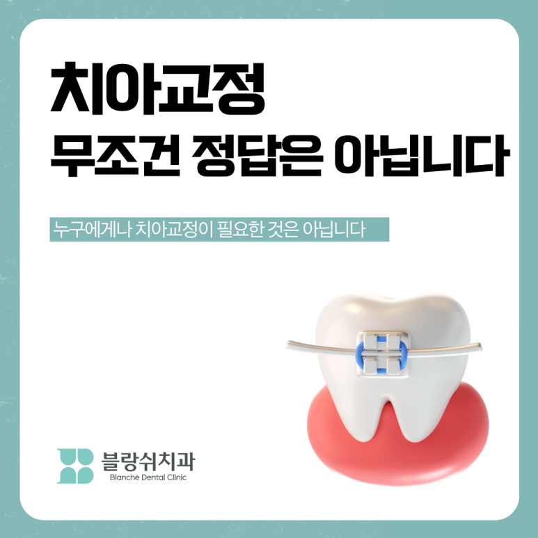 압구정 치아교정 무조건 정답은 아닙니다 관련 이미지 1