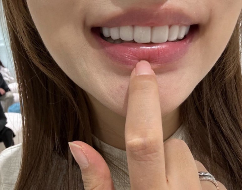 이제 라미네이트 말고 관련 이미지 3