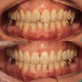 서초교정치과, 20년차 교정 전문의가 모두 대답해드립니다. <의사 작성> 관련 이미지 12