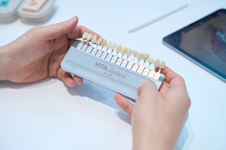 커피 치아착색? 누런 치아가 신경 쓰인다면 지금 확인하세요. 관련 이미지 5