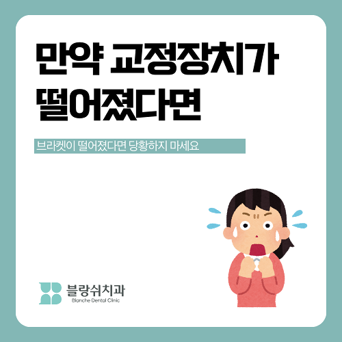 반포동 치과 교정 치료 중 음식 섭취 주의사항 (꼭 피해야 할 음식 vs 추천 음식) 관련 이미지 4
