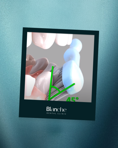 양치할 때 "이것"만 보고 따라하시면 치과 오는 일 적어집니다 관련 이미지 6